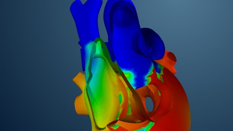 Living Heart. Zdroj: Dassault Systèmes