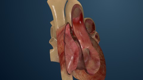 Living Heart. Zdroj: Dassault Systèmes